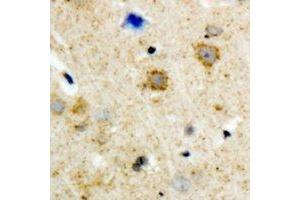 Immunohistochemical analysis of GRK3 staining in human brain formalin fixed paraffin embedded tissue section.