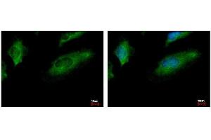 ICC/IF Image CoCoA antibody [N2C2], Internal detects CALCOCO1 protein at cytoplasm by immunofluorescent analysis.