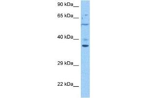 Host:  Rabbit  Target Name:  TMEM173  Sample Tissue:  Human 786-0 Whole Cell  Antibody Dilution:  1ug/ml