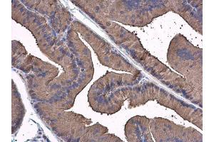 IHC-P Image FAK antibody detects FAK protein at cytoplasm in rat prostate by immunohistochemical analysis.