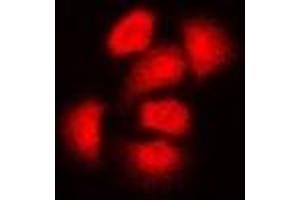 Immunofluorescent analysis of ASC-1 staining in Hela cells. (TRIP4 anticorps)