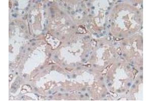 IHC-P analysis of Human Kidney Tissue, with DAB staining. (P-Selectin anticorps  (AA 198-432))