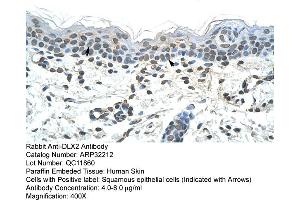 Human Skin (DLX2 anticorps  (C-Term))
