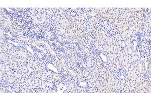 Detection of AGRN in Human Kidney Tissue using Polyclonal Antibody to Agrin (AGRN)
