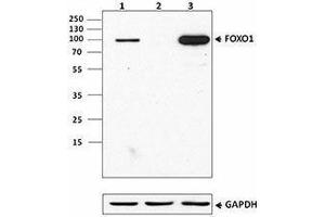 Western Blotting (WB) image for anti-Forkhead Box O1 (FOXO1) antibody (ABIN2664978) (FOXO1 anticorps)