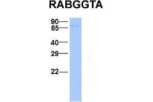 Host:  Rabbit  Target Name:  RABGGTA  Sample Type:  Hela  Antibody Dilution:  1. (RABGGTA anticorps  (N-Term))
