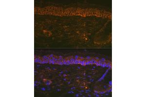Immunofluorescence analysis of Mouse tail and ear using Cytokeratin 16 (KRT16) Rabbit mAb (ABIN7268094) at dilution of 1:100 (40x lens). (KRT16 anticorps)