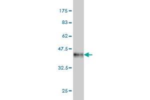 Western Blot detection against Immunogen (40. (TESK2 anticorps  (AA 405-542))