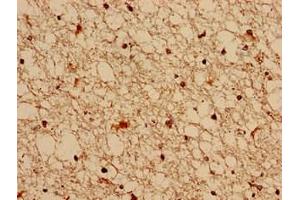 Immunocytochemistry analysis of human brain tissue using ABIN7153269 at dilution of 1:100