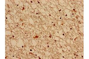 Immunocytochemistry analysis of human brain tissue using ABIN7153269 at dilution of 1:100 (FGD6 anticorps  (AA 1138-1352))