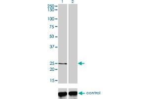 Western blot analysis of PCTP over-expressed 293 cell line, cotransfected with PCTP Validated Chimera RNAi (Lane 2) or non-transfected control (Lane 1). (PCTP anticorps  (AA 1-214))