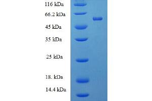SDS-PAGE (SDS) image for Protein tyrosine Phosphatase, Receptor Type, R (PTPRR) (AA 1-412), (full length) protein (His-SUMO Tag) (ABIN5711341)