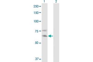 Western Blot analysis of IL2RB expression in transfected 293T cell line by IL2RB MaxPab polyclonal antibody. (IL2 Receptor beta anticorps  (AA 1-551))
