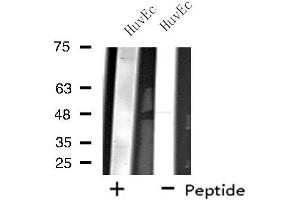 Western blot analysis of extracts from HuvEc cells, using ZNF446 antibody. (ZNF446 anticorps  (Internal Region))