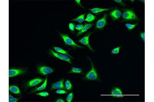 Immunofluorescence of purified MaxPab antibody to P4HB on HeLa cell.