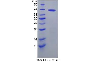 Image no. 1 for Brevican (BCAN) (AA 23-353) protein (His tag) (ABIN4989040)