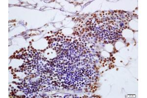 Formalin-fixed and paraffin embedded mouse pancreas labeled with Anti-FAM129A Polyclonal Antibody, Unconjugated (ABIN717701) at 1:200 followed by conjugation to the secondary antibody and DAB staining (Niban anticorps  (AA 455-550))
