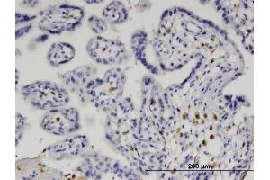 Immunoperoxidase of monoclonal antibody to IRF5 on formalin-fixed paraffin-embedded human placenta.