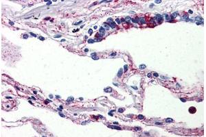 Human Lung (formalin-fixed, paraffin-embedded) stained with C5AR1 antibody ABIN461687 followed by biotinylated goat anti-rabbit IgG secondary antibody ABIN481713, alkaline phosphatase-streptavidin and chromogen. (C5AR1 anticorps  (Internal Region))