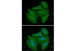 ICC/IF analysis of CALB2 in HeLa cells line, stained with DAPI (Blue) for nucleus staining and monoclonal anti-human CALB2 antibody (1:100) with goat anti-mouse IgG-Alexa fluor 488 conjugate (Green).