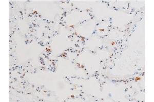 ABIN6267602 at 1/200 staining Rat lung tissue sections by IHC-P. (NF-kB p65 anticorps  (pSer281))