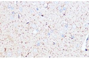 Immunohistochemistry of paraffin-embedded Rat brain using MAOA Polyclonal Antibody at dilution of 1:100 (40x lens). (Monoamine Oxidase A anticorps)