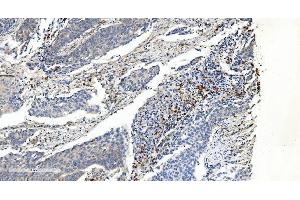 IHC analysis of APPL/APPL1 using anti-APPL/APPL1 antibody (ABIN7602659).