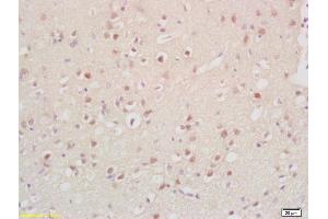 Formalin-fixed and paraffin embedded rat brain labeled with Anti-Cyclin G2 Polyclonal Antibody, Unconjugated (ABIN704621) at 1:200, followed by conjugation to the secondary antibody and DAB staining (Cyclin G2 anticorps  (AA 151-250))