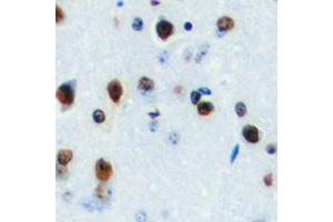 Immunohistochemical analysis of LYL1 staining in human brain formalin fixed paraffin embedded tissue section.