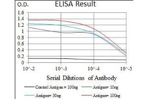 Black line: Control Antigen (100 ng), Purple line: Antigen(10 ng), Blue line: Antigen (50 ng), Red line: Antigen (100 ng),