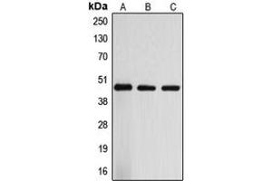 Western blot analysis of ARRDC3 expression in Jurkat (A), mouse liver (B), rat liver (C) whole cell lysates. (ARRDC3 anticorps  (C-Term))