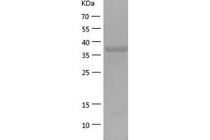 Western Blotting (WB) image for RAB3A Interacting Protein (Rabin3)-Like 1 (RAB3IL1) (AA 1-382) protein (His-IF2DI Tag) (ABIN7124754)