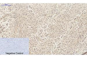 Immunohistochemical analysis of paraffin-embedded human uterus tissue.