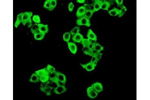Detection of PKR in MCF7 cells using Polyclonal Antibody to Protein Kinase R (PKR)