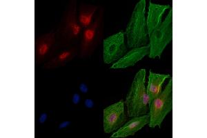 ABIN6259230 and ABIN6274702 staining  cells by IF/ICC. (ATRX anticorps  (C-Term))