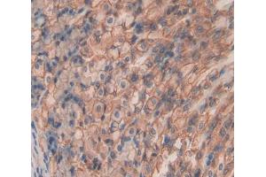 Used in DAB staining on fromalin fixed paraffin- embedded Kidney tissue