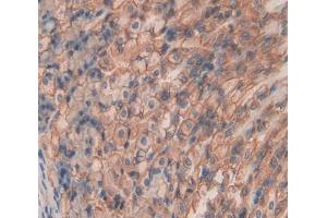 Used in DAB staining on fromalin fixed paraffin- embedded Kidney tissue (SHISA4 anticorps  (AA 28-197))