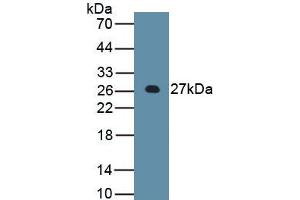 WB of Protein Standard: different control antibodies  against Highly purified E.