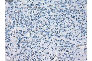 Immunohistochemical staining of paraffin-embedded endometrium tissue using anti-FCGR2A mouse monoclonal antibody. (FCGR2A anticorps)