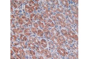 Used in DAB staining on fromalin fixed paraffin- embedded stomach tissue (MMP14 anticorps  (AA 322-541))
