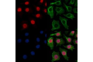 MYEOV Antibody staining HepG2 cells by IF/ICC. (MYEOV anticorps  (Internal Region))