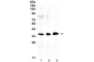 Western blot testing of human 1) HeLa, 2) COLO320 and 3) SW620 cell lysate with AKR1B10 antibody at 0. (AKR1B10 anticorps  (AA 285-316))
