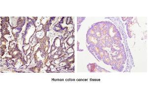 Immunohistochemistry (IHC) image for anti-Acyl-CoA Thioesterase 11 (ACOT11) (AA 19-250) antibody (ABIN317516)