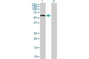 Western Blot analysis of ST8SIA2 expression in transfected 293T cell line by ST8SIA2 MaxPab polyclonal antibody. (ST8SIA2 anticorps  (AA 1-354))