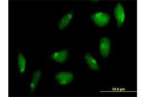 Immunofluorescence of purified MaxPab antibody to TTK on HeLa cell.