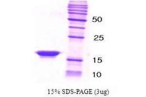 Figure annotation denotes ug of protein loaded and % gel used. (beta Synuclein Protéine)
