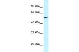 Image no. 1 for anti-Eyes Absent Homolog 2 (Drosophila) (EYA2) (AA 200-249) antibody (ABIN6747418)