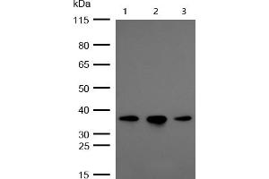 All lanes : OXGR1 Rabbit mAb at 1/1k dilution Lane 1 : Hela whole cell lysates Lane 2 : A549 whole cell lysates Lane 3 : HUVEC whole cell lysates Lysates/proteins at 20 μg per lane. (Recombinant OXGR1 anticorps)