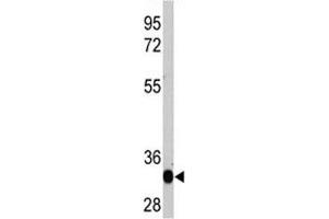 Western blot analysis of recombinant protein with LIN28A antibody (LIN28A anticorps)