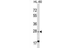 Western Blotting (WB) image for anti-Apolipoprotein O-Like (APOOL) antibody (ABIN2997795)